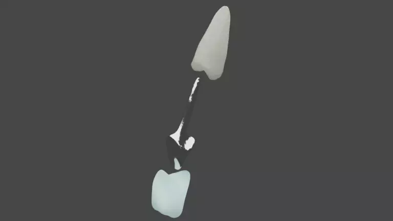Metallic cast post and crown - Anterior tooth 3D model