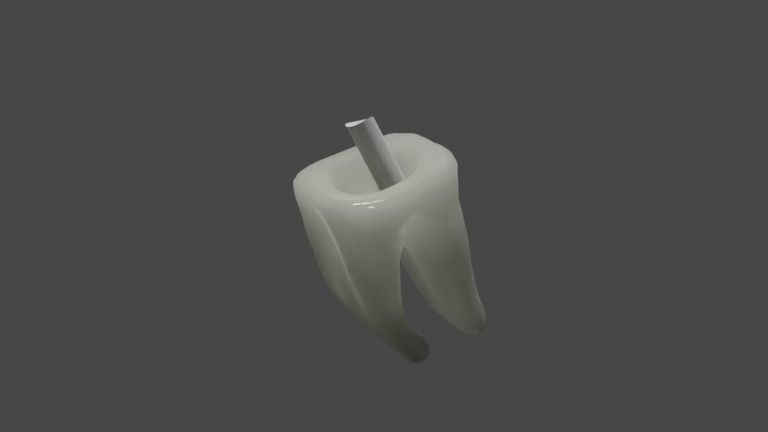 Fiber post and core with single crown - Posterior tooth 3D model_3