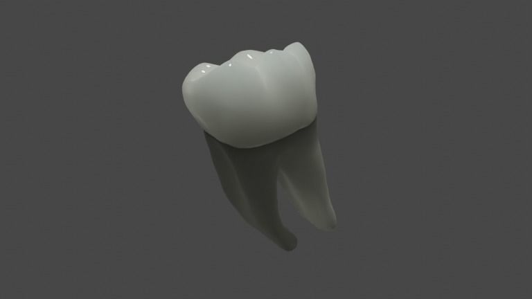 Fiber post and core with single crown - Posterior tooth 3D model_1