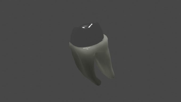 Metal cast post with single crown - Posterior tooth 3D model_2