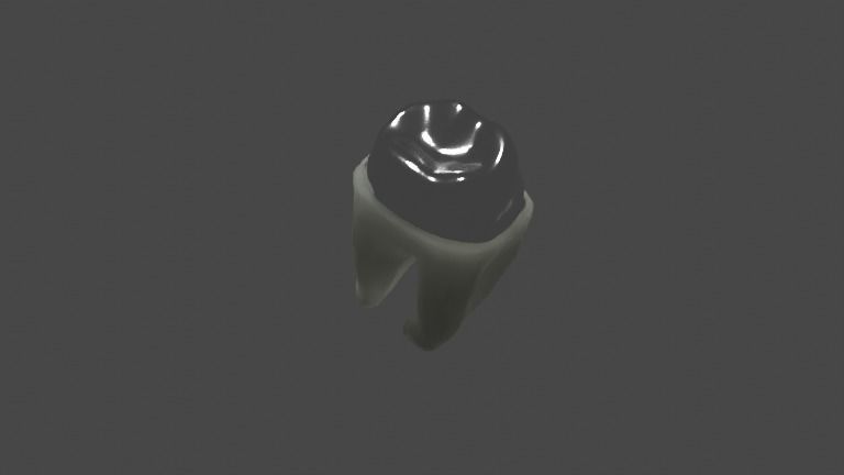 Metal cast post with single crown - Posterior tooth 3D model_3