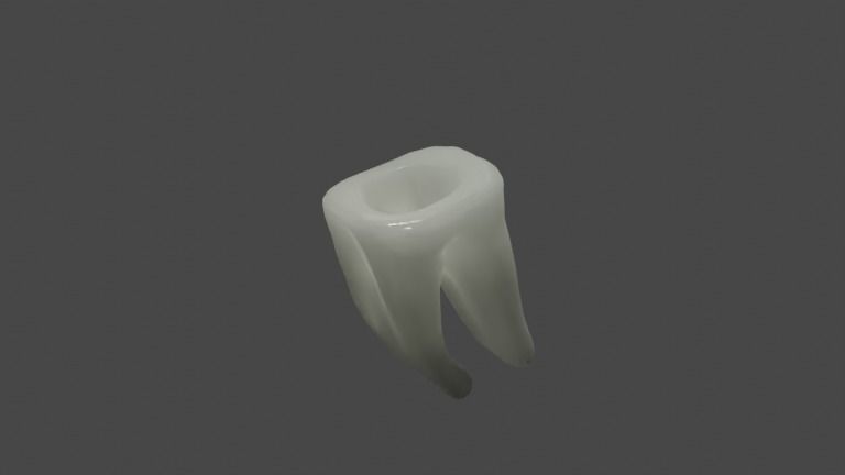 Metal cast post with single crown - Posterior tooth 3D model_4
