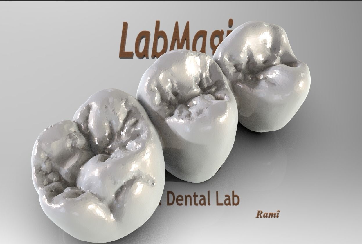 Digital Full Contour Bridge and Model 3D print model_2