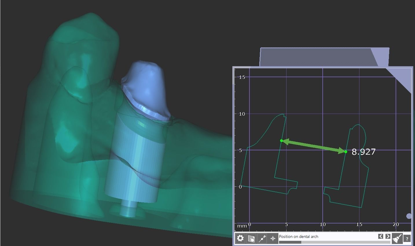 Digital Full Contour Bridge and Model 3D print model_18