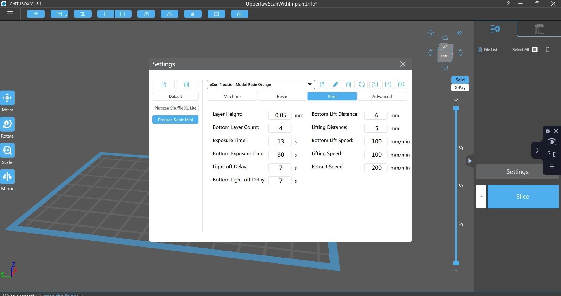Digital Full Contour Bridge and Model 3D print model_5