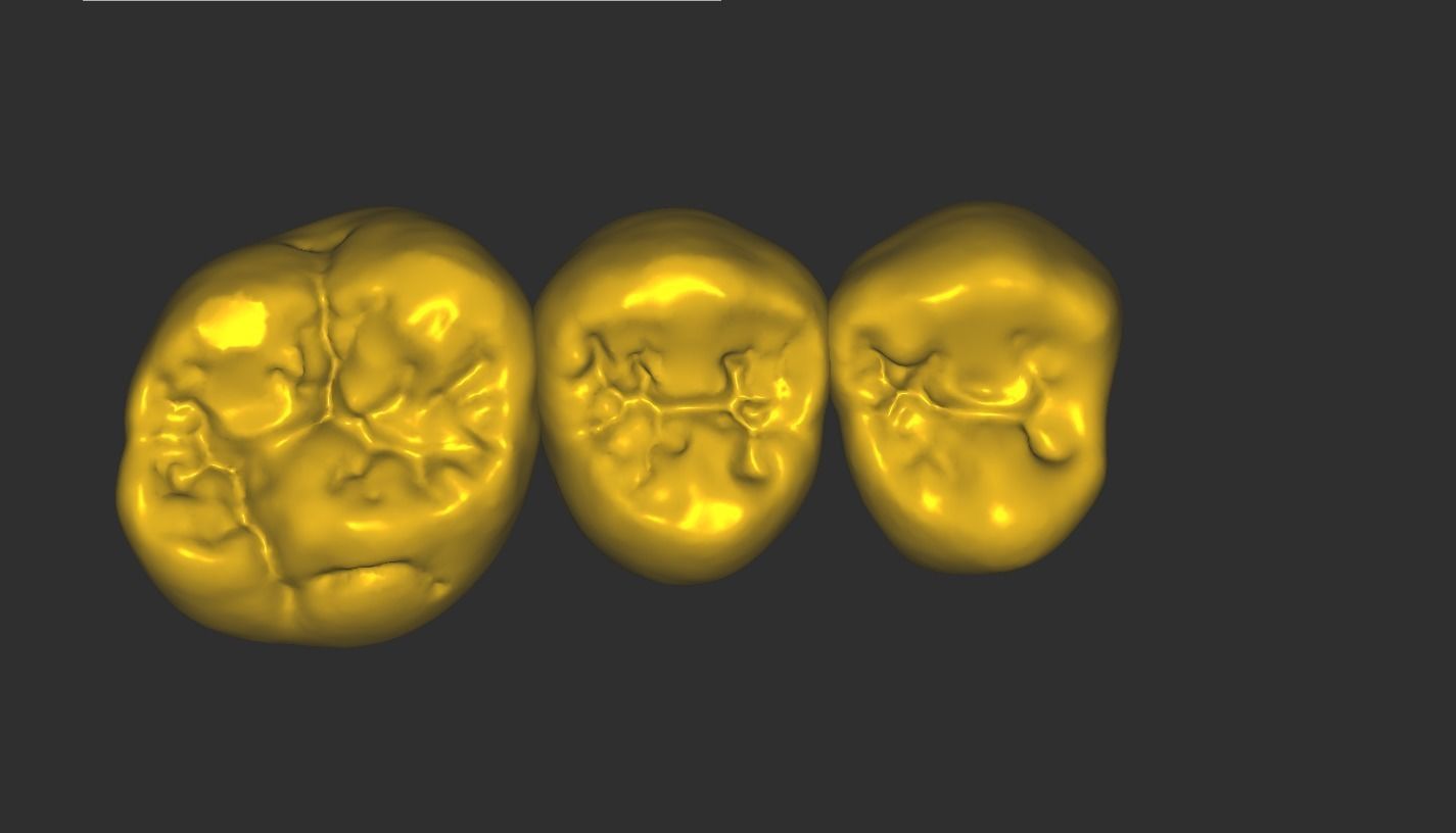 Digital Full Contour Bridge and Model 3D print model_9