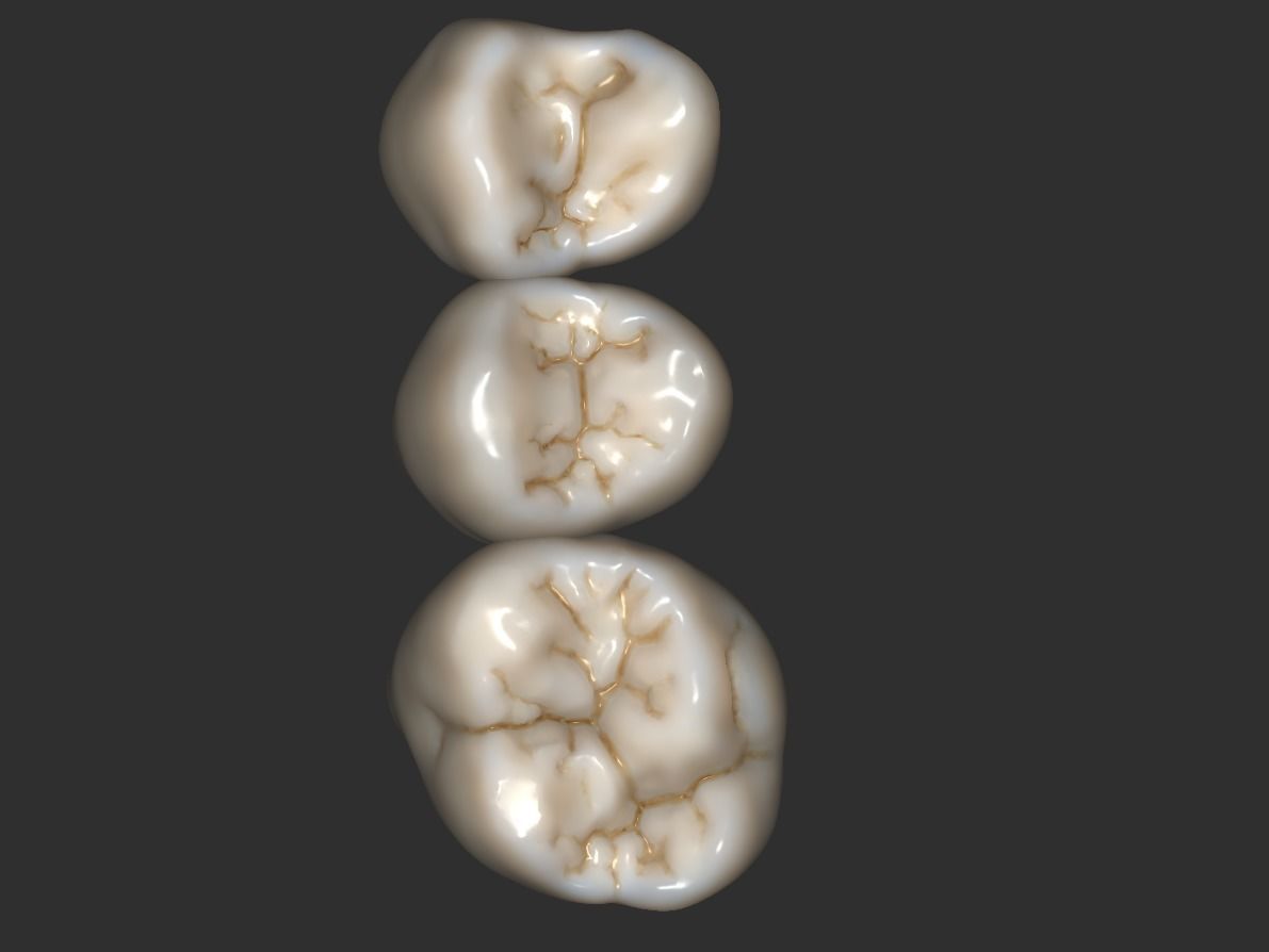 Digital Full Contour Bridge and Model 3D print model_11