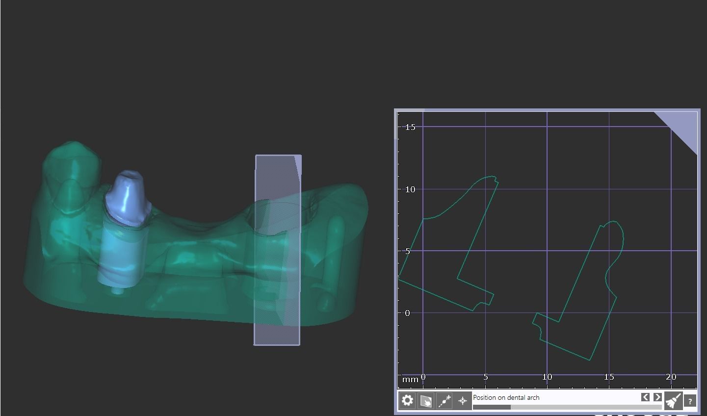 Digital Full Contour Bridge and Model 3D print model_6
