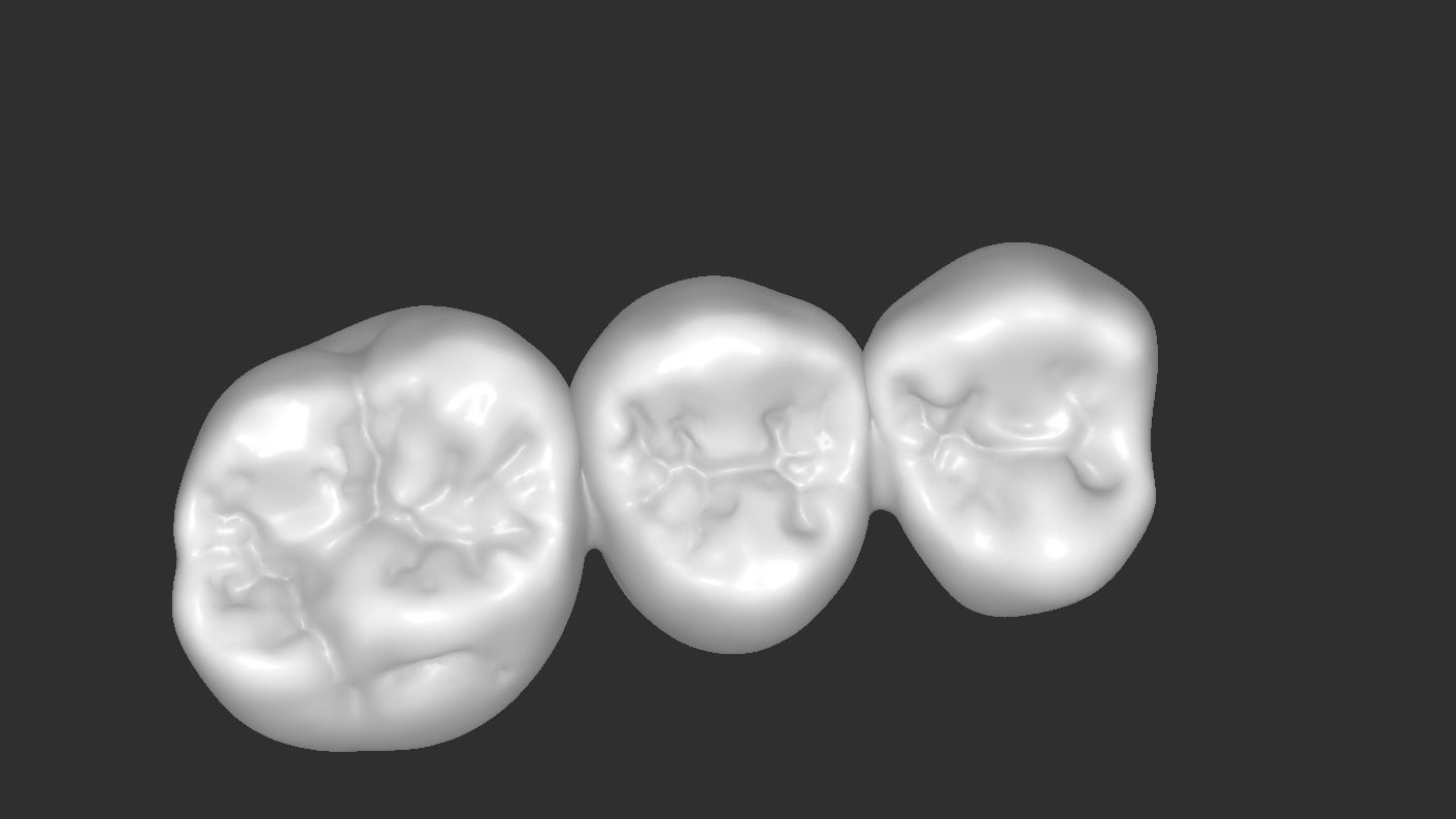 Digital Full Contour Bridge and Model 3D print model_4