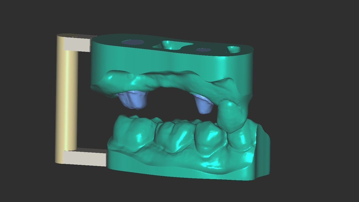 Digital Full Contour Bridge and Model 3D print model_7
