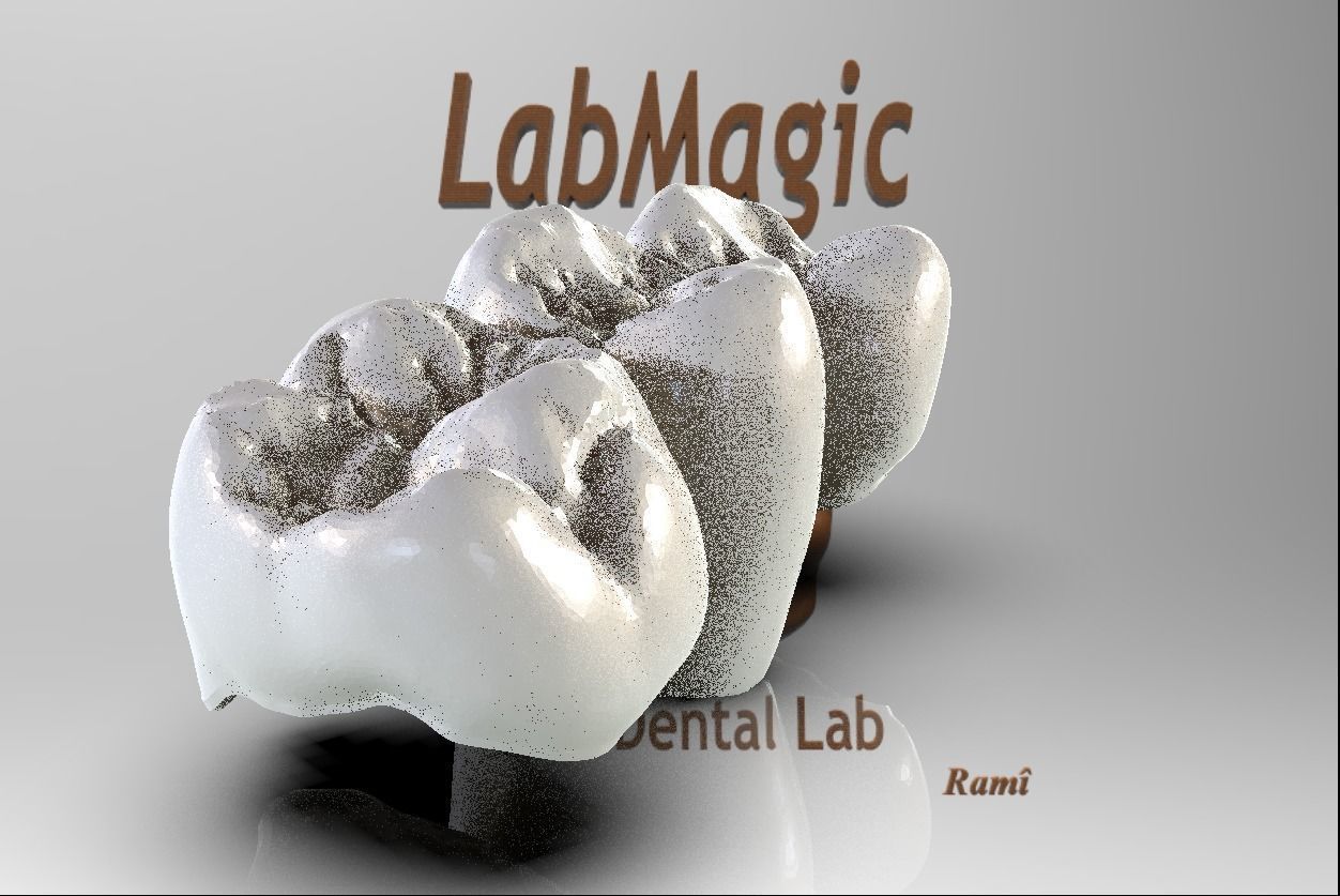 Digital Full Contour Bridge and Model 3D print model_1