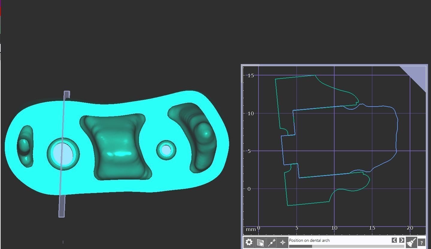 Digital Full Contour Bridge and Model 3D print model_3
