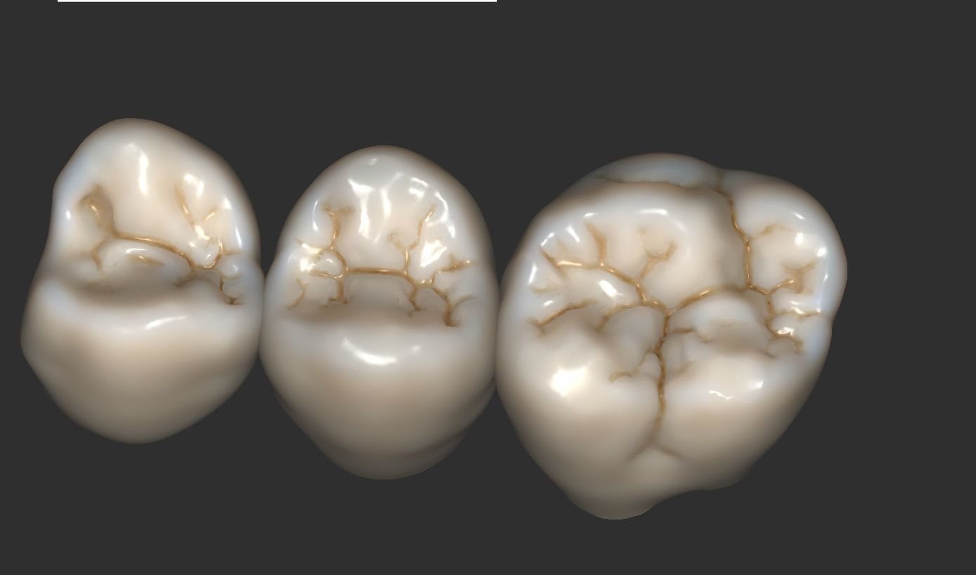 Digital Full Contour Bridge and Model 3D print model_14