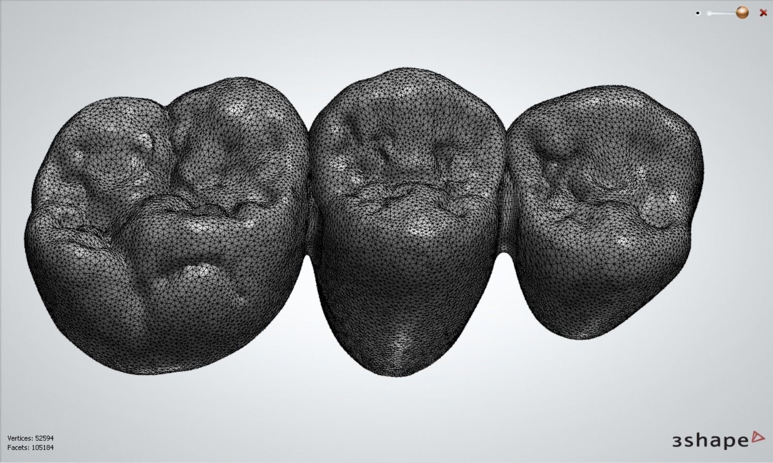 Digital Full Contour Bridge and Model 3D print model_24