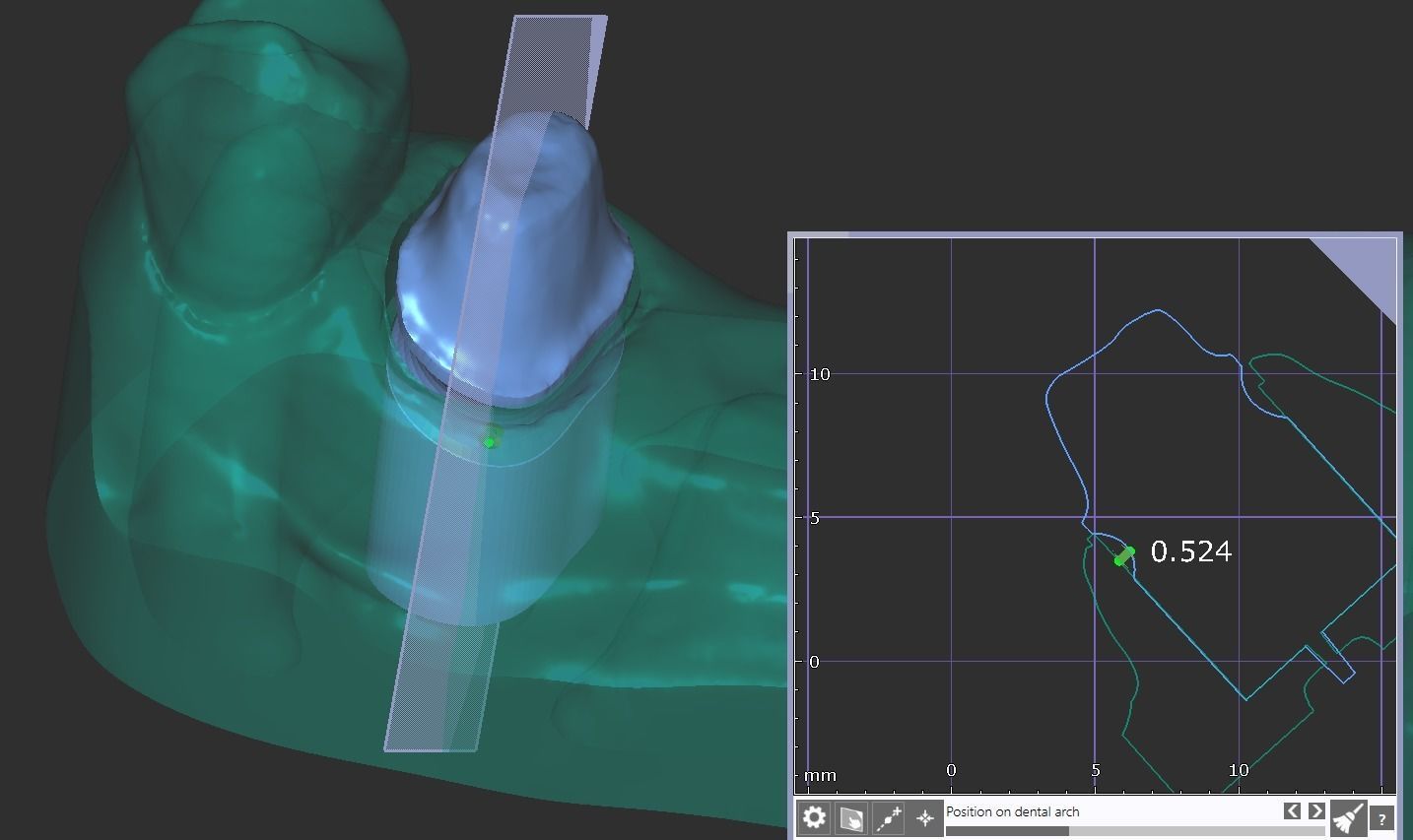 Digital Full Contour Bridge and Model 3D print model_10
