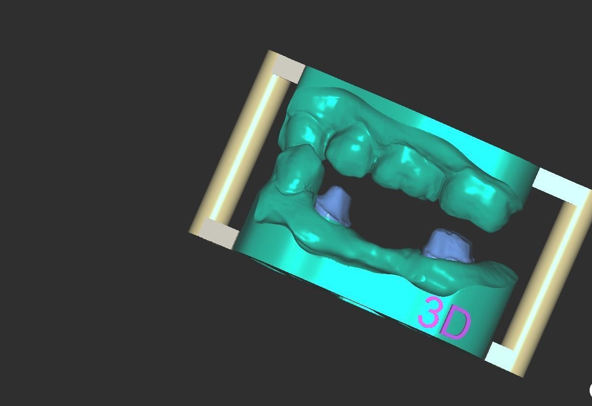 Digital Full Contour Bridge and Model 3D print model_19