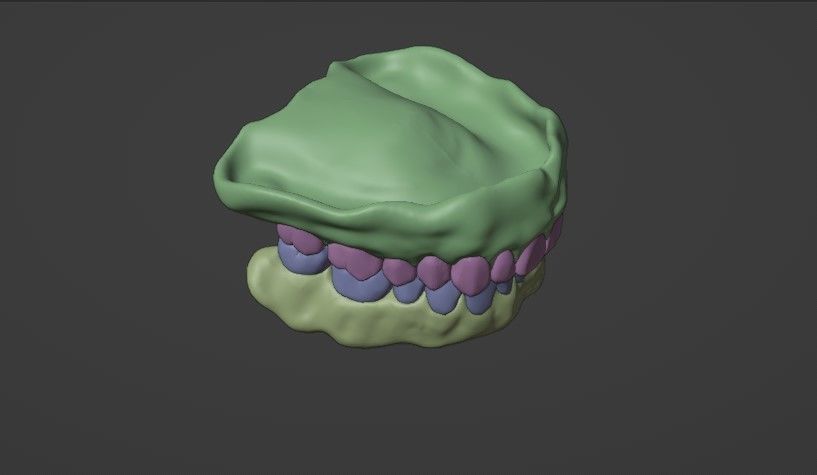 Complete dentures - prostheses 3D model_3
