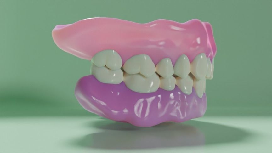 Complete dentures - prostheses 3D model_2