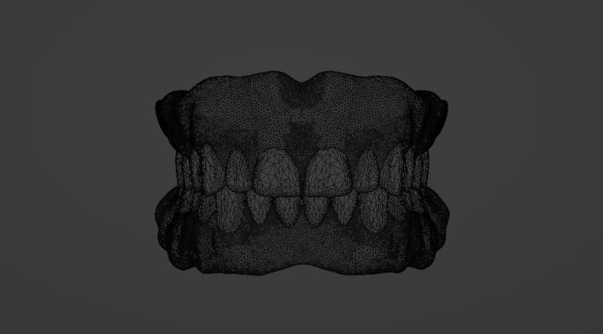 Complete dentures - prostheses 3D model_6