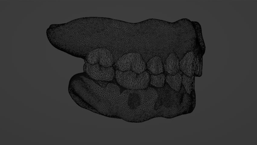 Complete dentures - prostheses 3D model_5