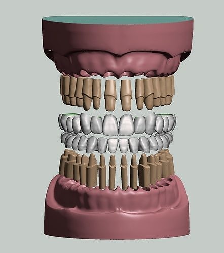 Maxillary and Mandibular dental models crowns and preped dies 3D print model