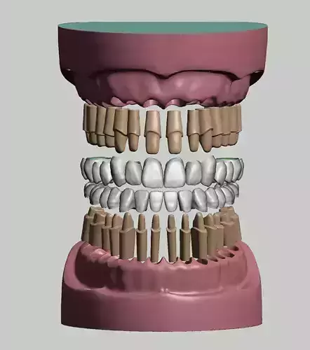 Maxillary and Mandibular dental models crowns and preped dies 3D print model