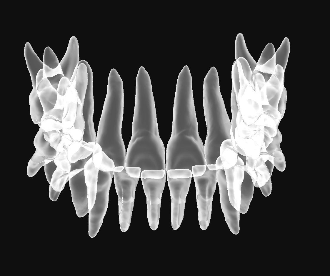 Human child skull anatomy model with individual teeth 3D print model_6