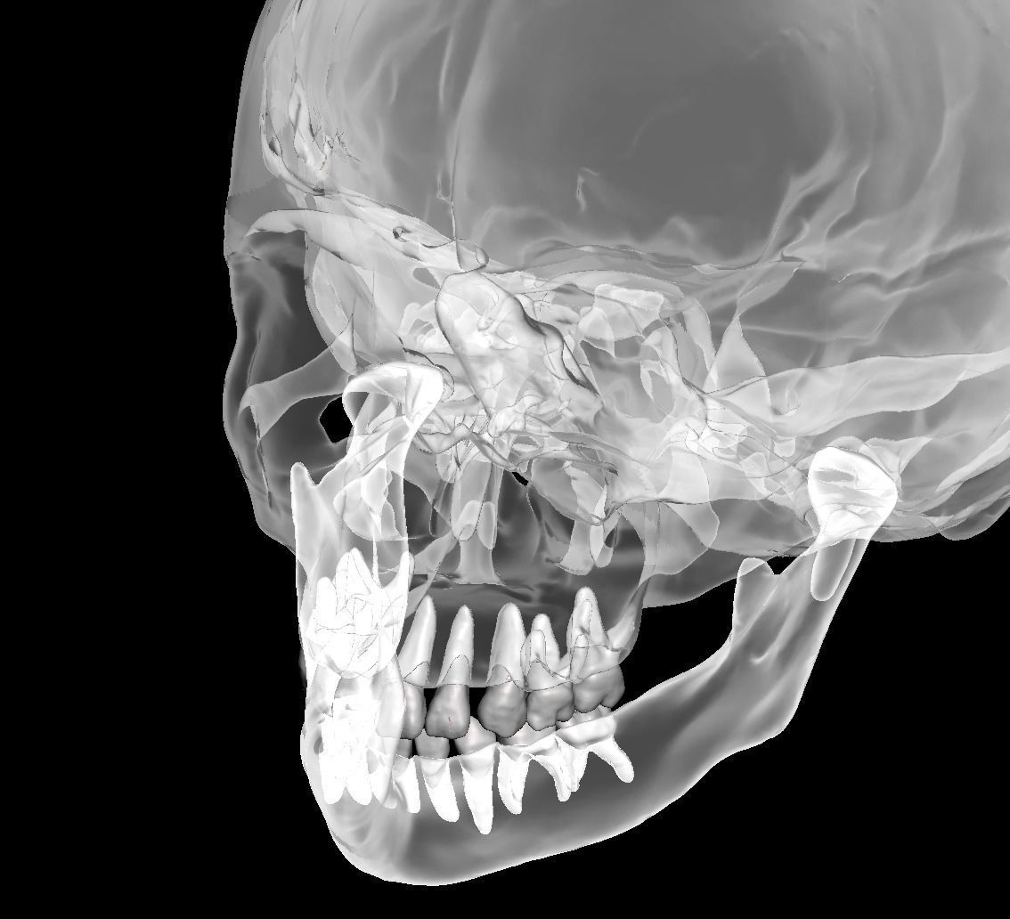 Human child skull anatomy model with individual teeth 3D print model_8
