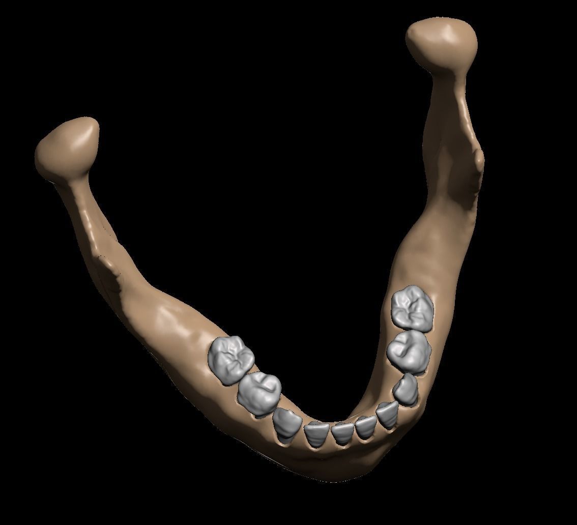Human child skull anatomy model with individual teeth 3D print model_10