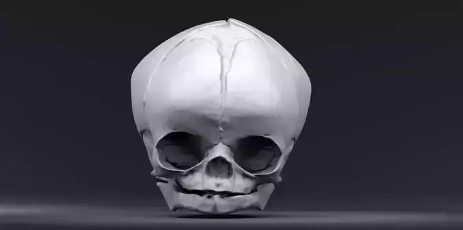 Fetal Skull 