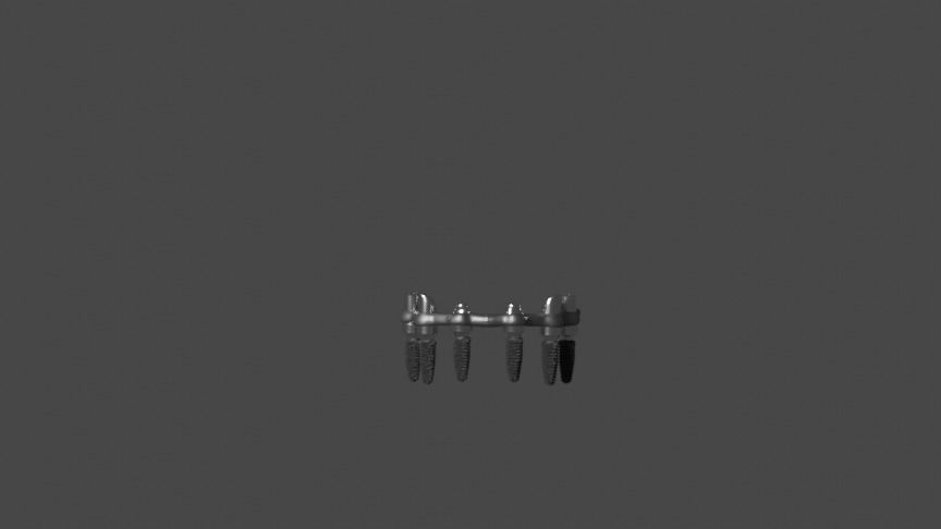 Full arch fixed implant-supported prostheses - Lower arch 3D model_5