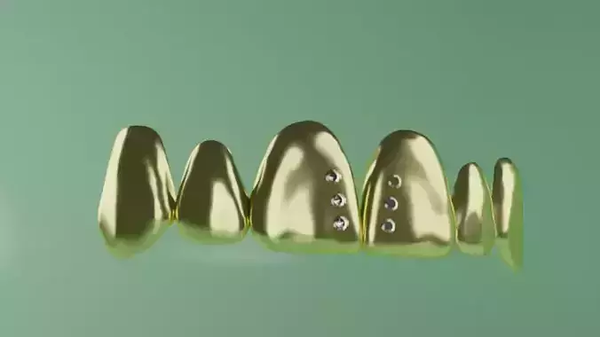  Grillz with diamonds in the front teeth