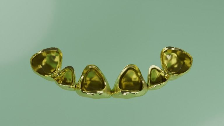 Grillz with textured teeth - gold 3D model_3