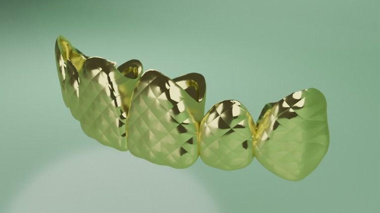 Grillz with textured teeth - gold 3D model_1