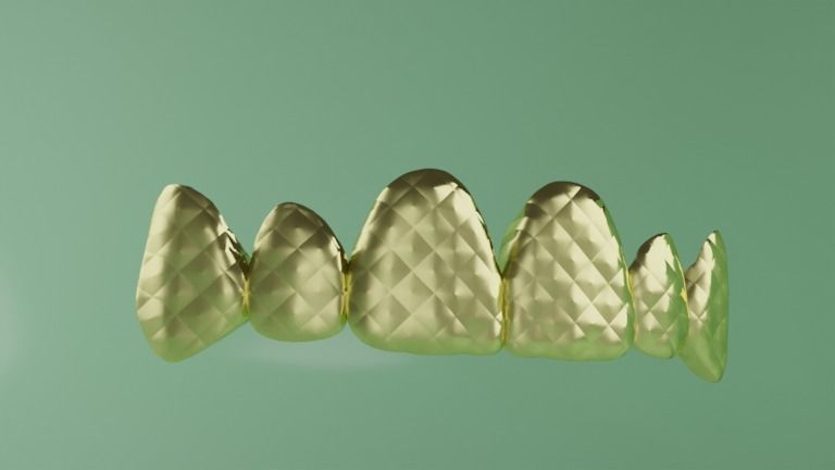 Grillz with textured teeth - gold 3D model_2