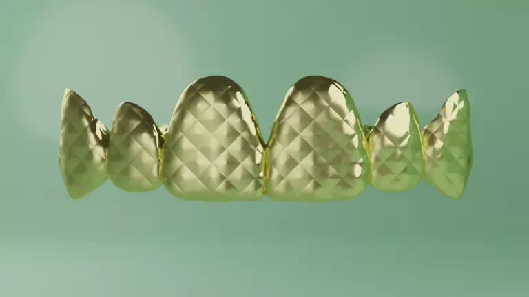 Grillz with textured teeth - gold 3D model_0
