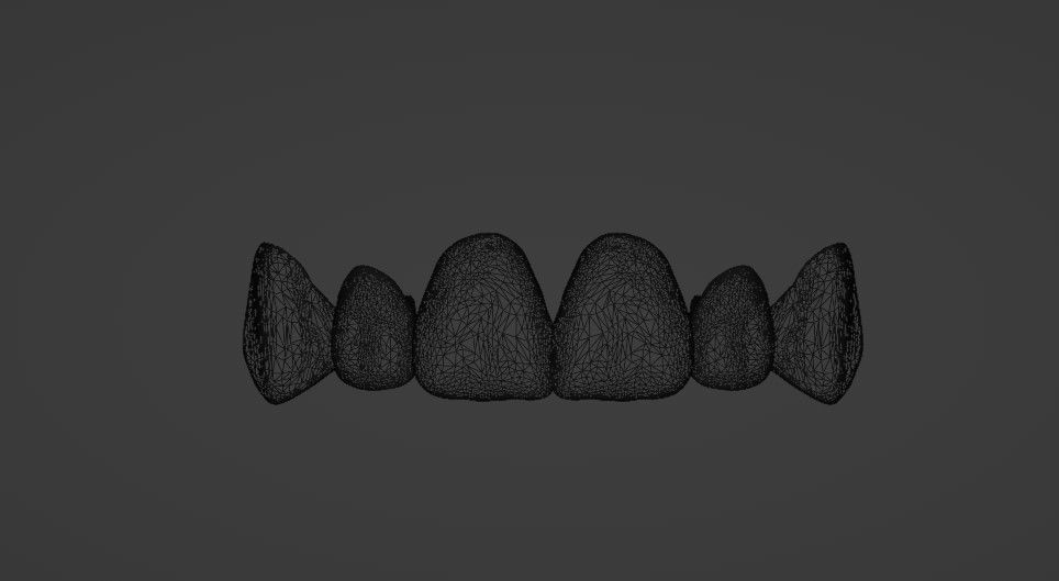 Grillz with textured teeth - gold 3D model_5