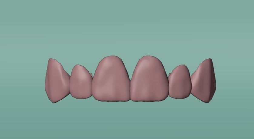 Grillz with textured teeth - gold 3D model_7