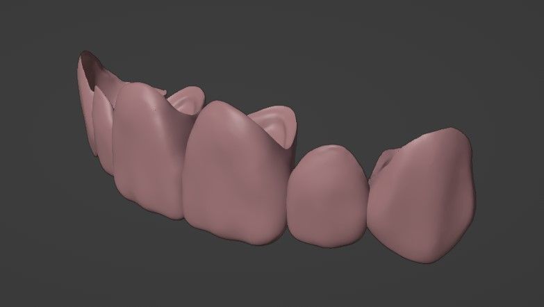 Grillz with textured teeth - gold 3D model_4