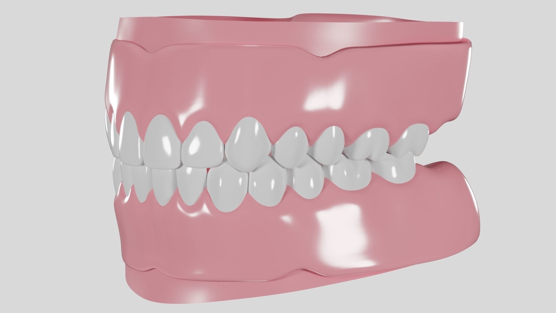 Hibrid implant bar attachment 3D model_1