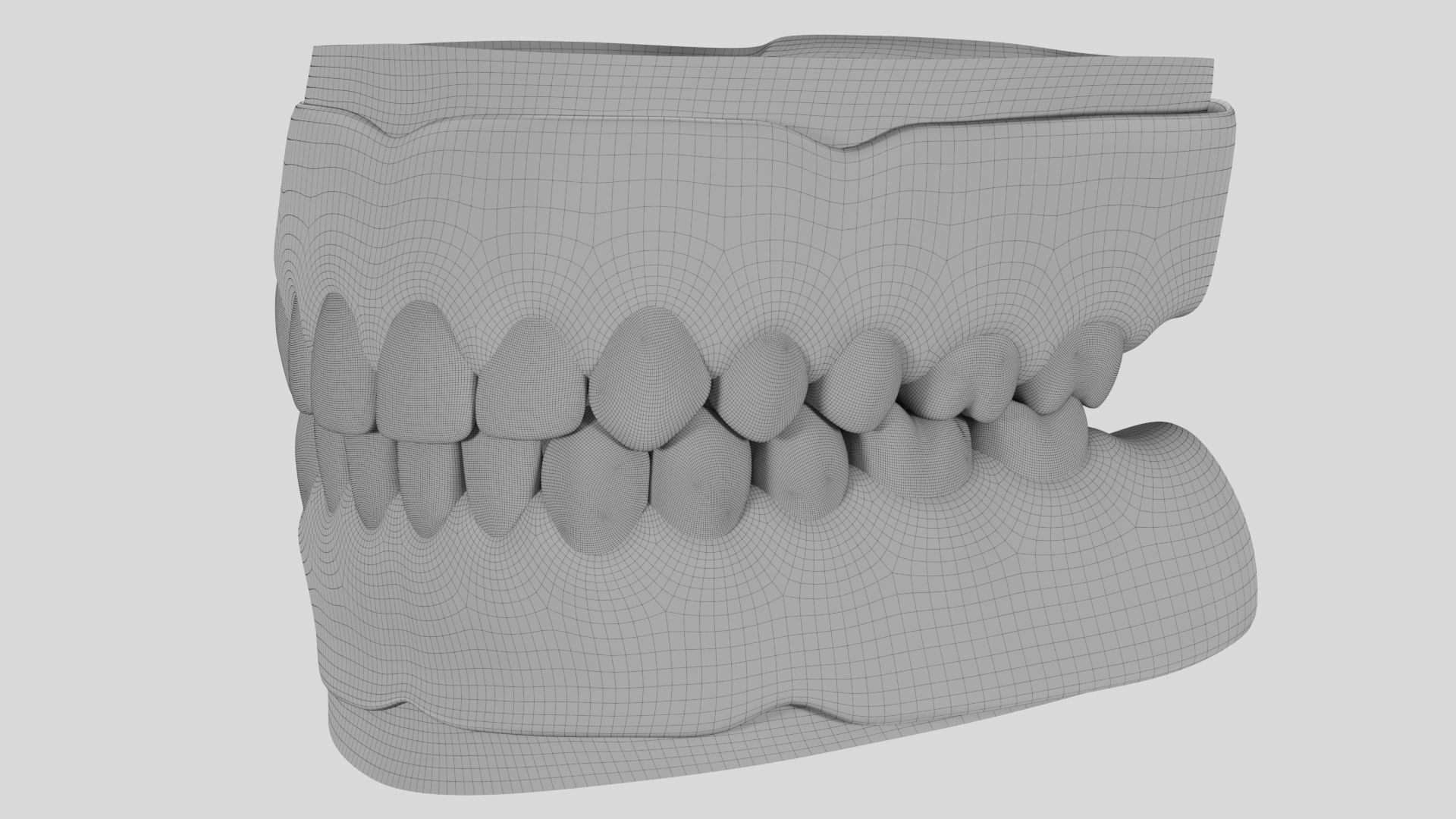 Hibrid implant bar attachment 3D model_2