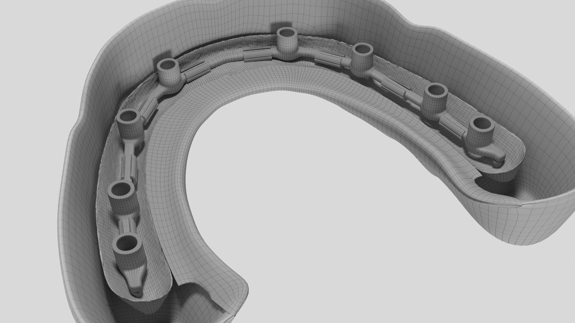 Hibrid implant bar attachment 3D model_4