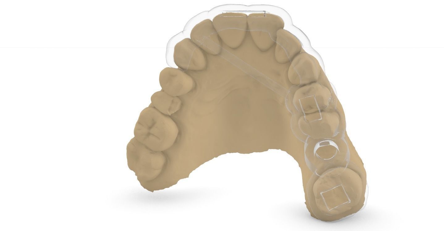 Digital Surgical Guide  3D print model_14