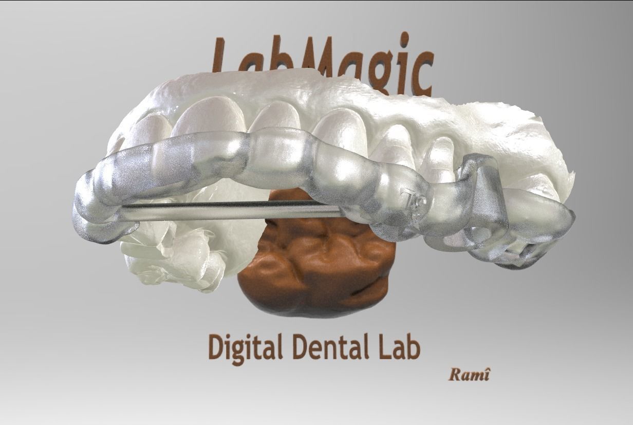 Digital Surgical Guide  3D print model_8