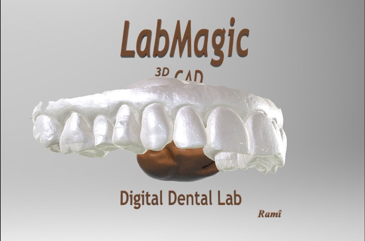 Digital Surgical Guide  3D print model_6