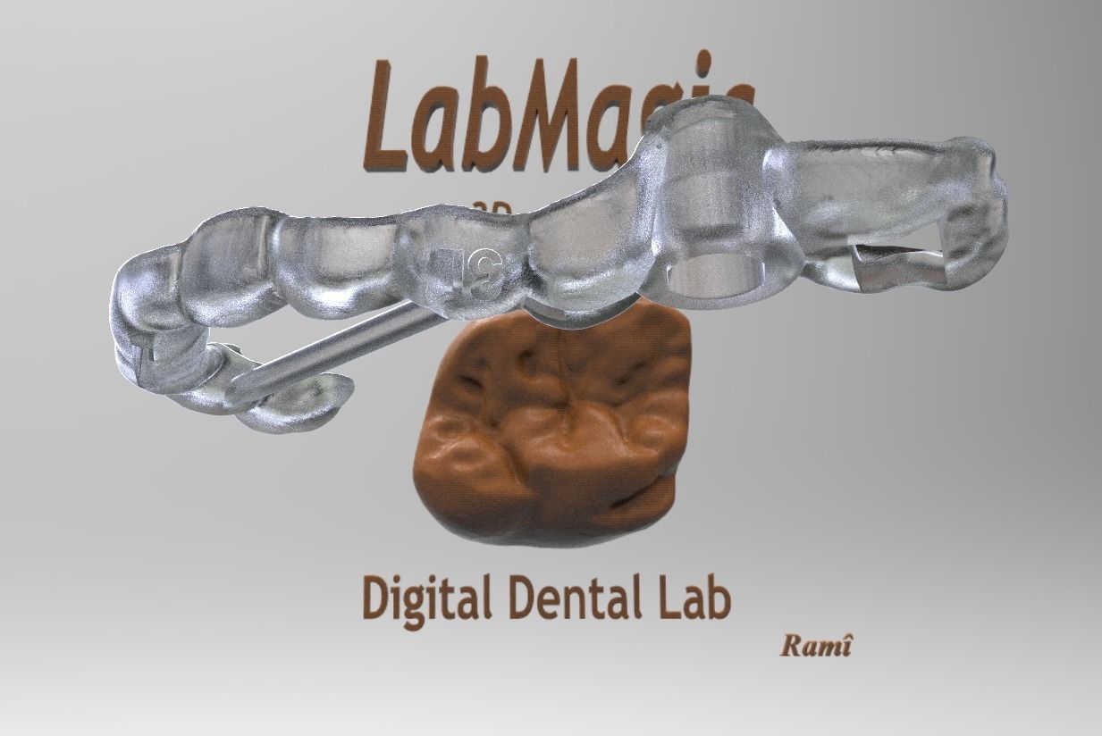 Digital Surgical Guide  3D print model_11