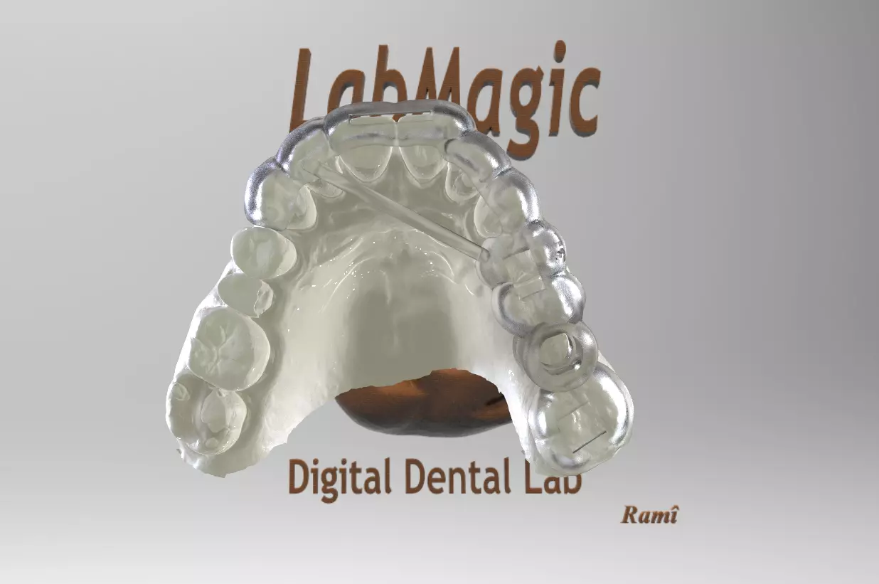 Digital Surgical Guide  3D print model_0
