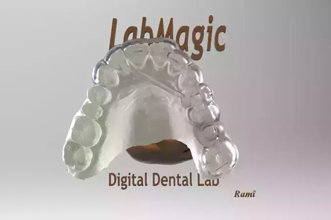 Digital Surgical Guide  3D print model