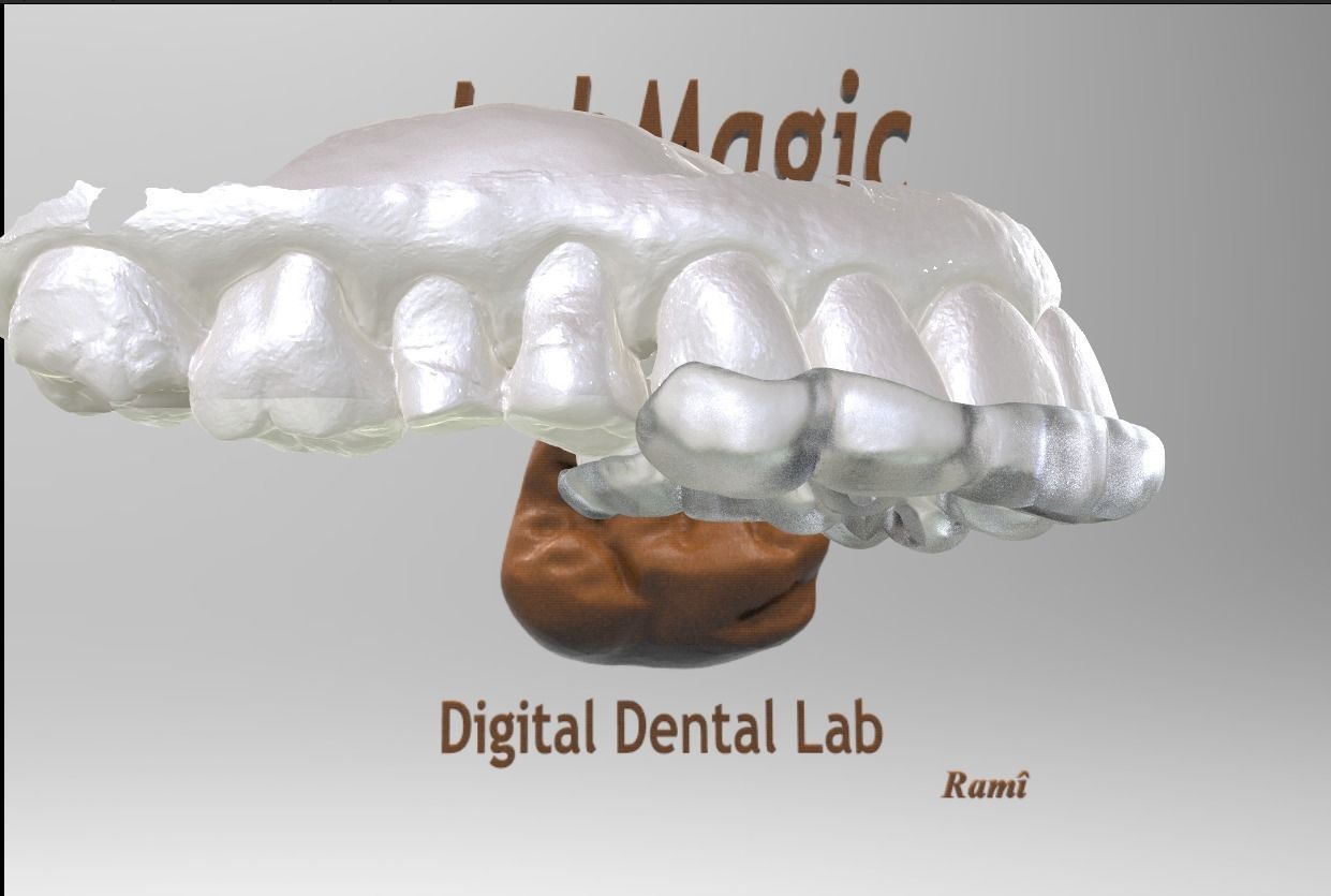 Digital Surgical Guide  3D print model_9
