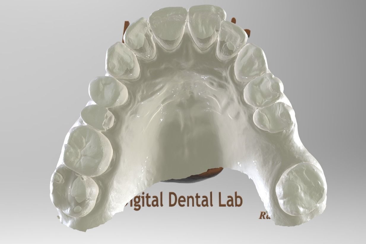 Digital Surgical Guide  3D print model_4